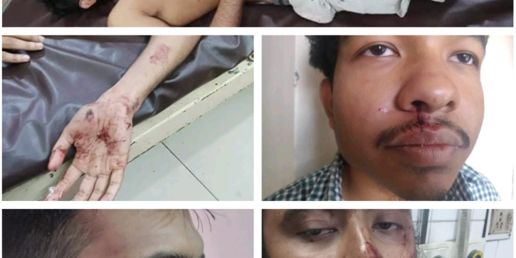 ঢাবিতে রমজানের বিষয়ক সেমিনারে ছাত্রলীগের নৃশংস হামলা
